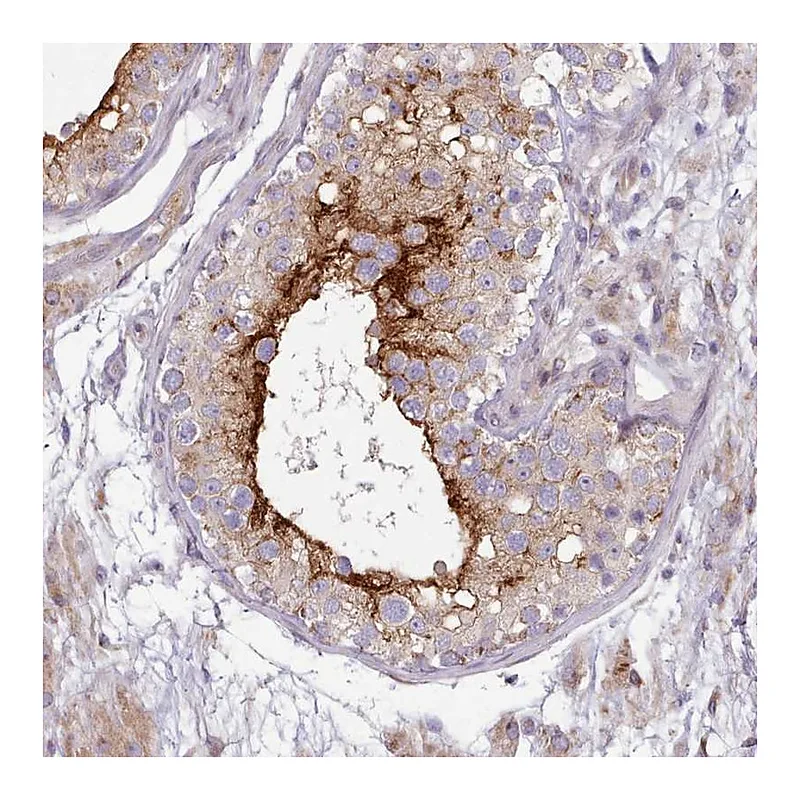 Atlas Antibodies Anti-SLC52A3 Antibody