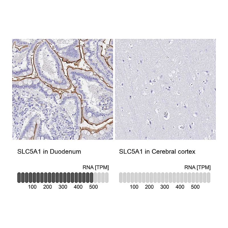 Atlas Antibodies Anti-SLC5A1 Antibody