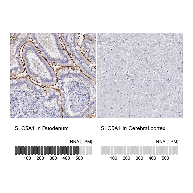 Atlas Antibodies Anti-SLC5A1 Antibody