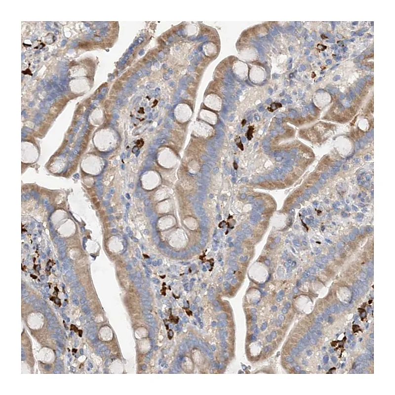 Atlas Antibodies Anti-SLC5A11 Antibody