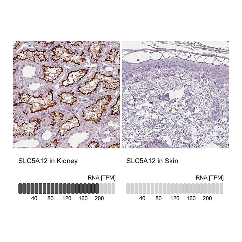 Atlas Antibodies Anti-SLC5A12 Antibody