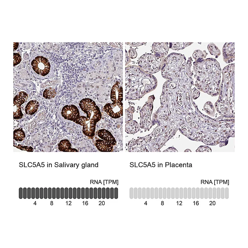 Atlas Antibodies Anti-SLC5A5 Antibody