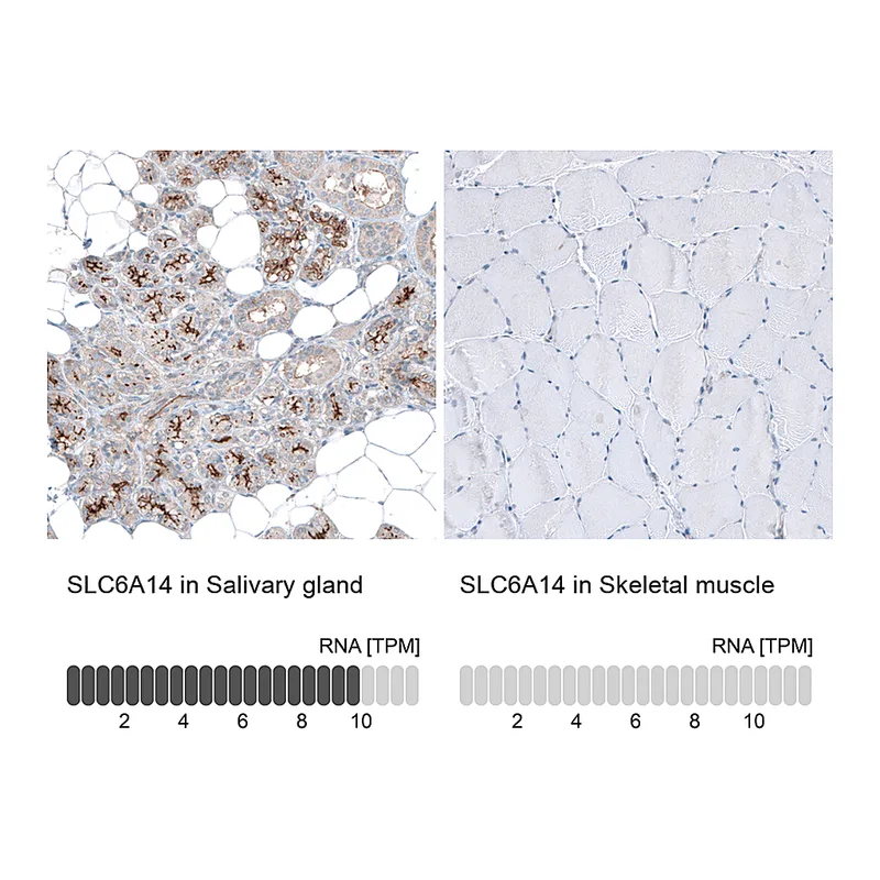 Atlas Antibodies Anti-SLC6A14 Antibody
