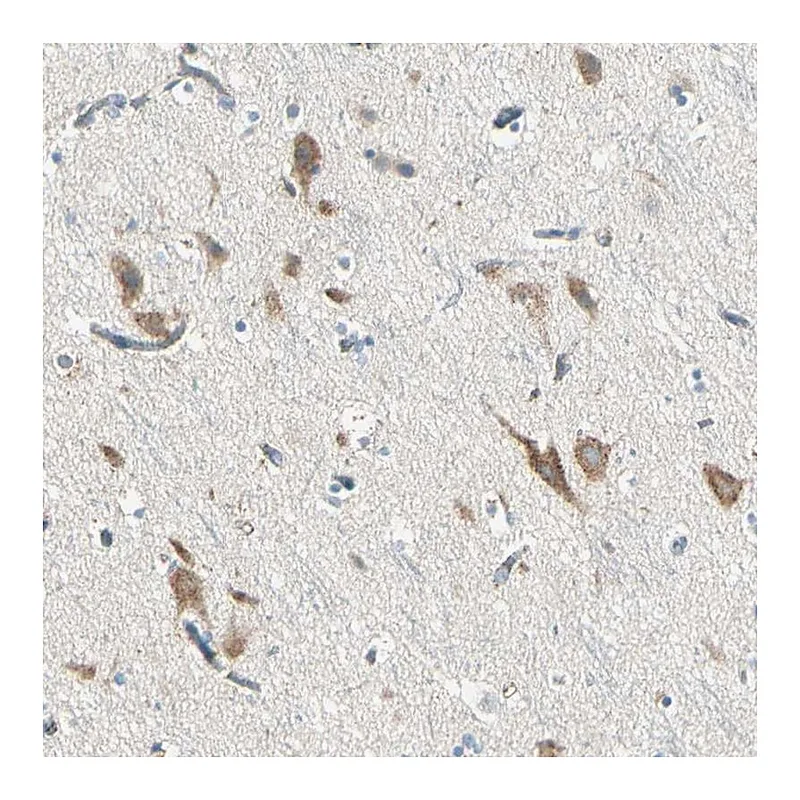 Atlas Antibodies Anti-SLC6A15 Antibody