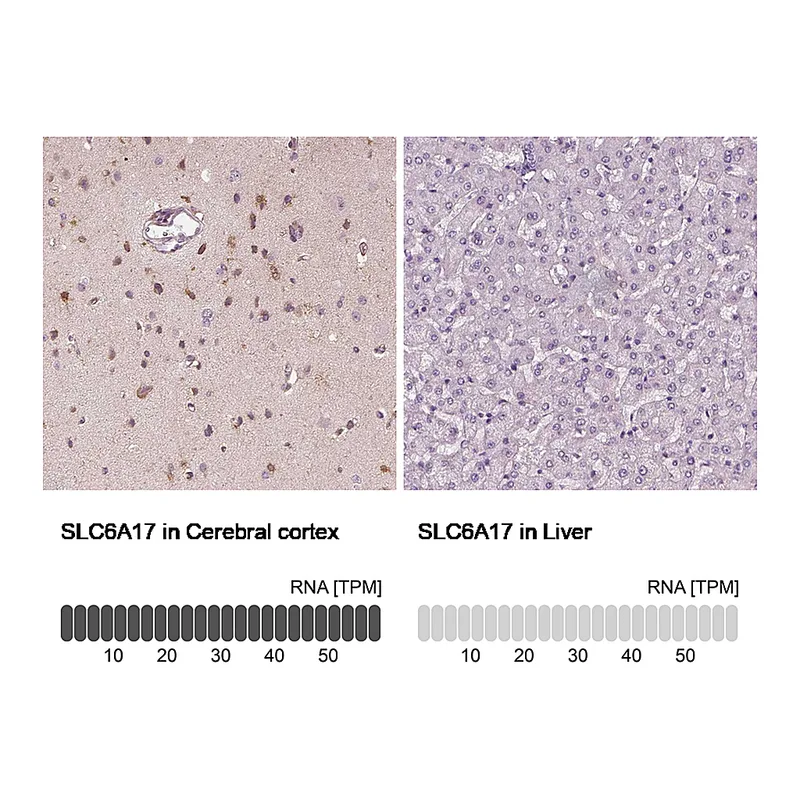 Atlas Antibodies Anti-SLC6A17 Antibody