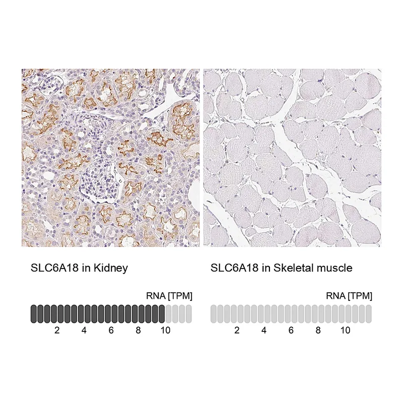 Atlas Antibodies Anti-SLC6A18 Antibody