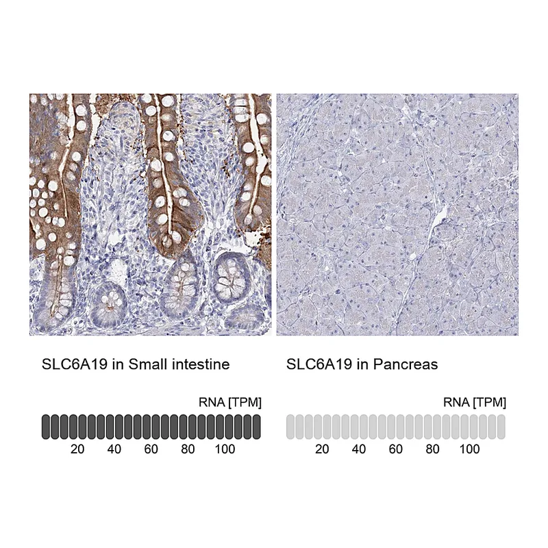 Atlas Antibodies Anti-SLC6A19 Antibody