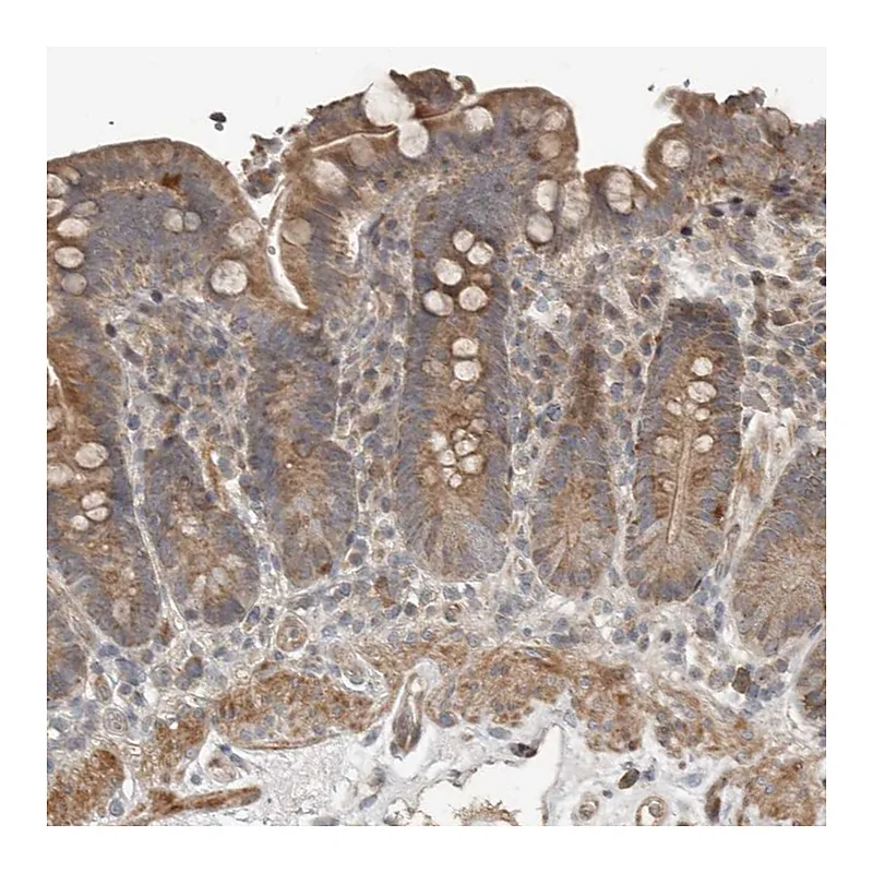 Atlas Antibodies Anti-SLC6A7 Antibody