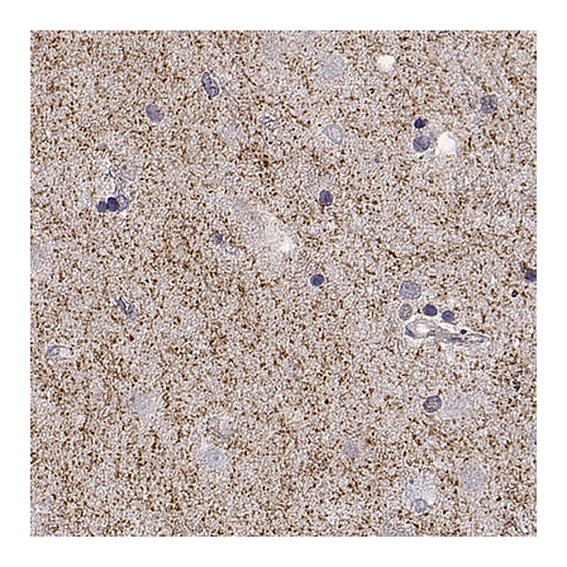 Atlas Antibodies Anti-SLC6A3 Antibody