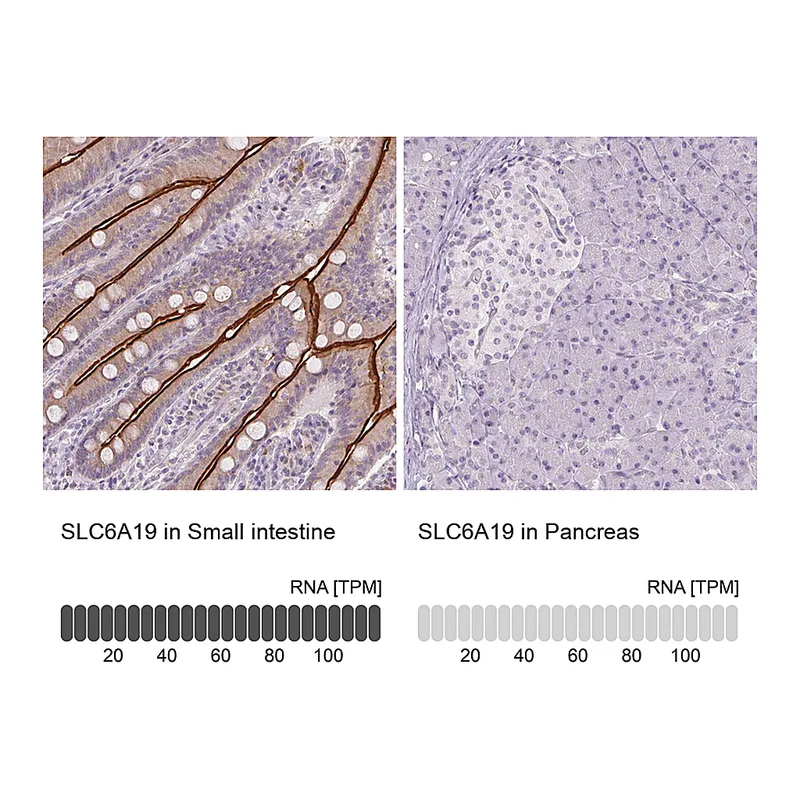 Atlas Antibodies Anti-SLC6A19 Antibody