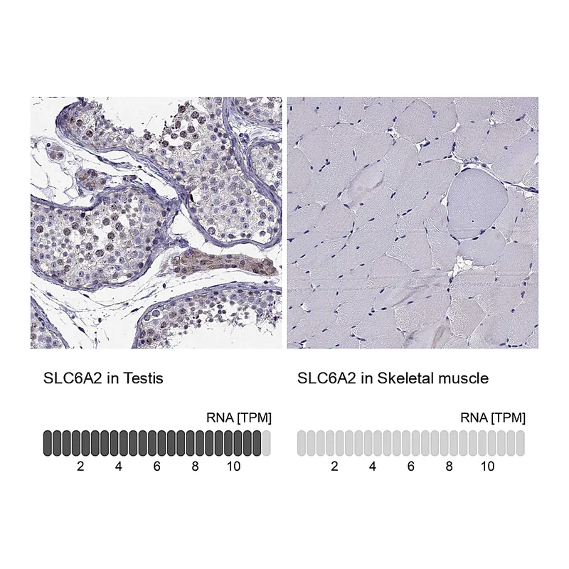 Atlas Antibodies Anti-SLC6A2 Antibody