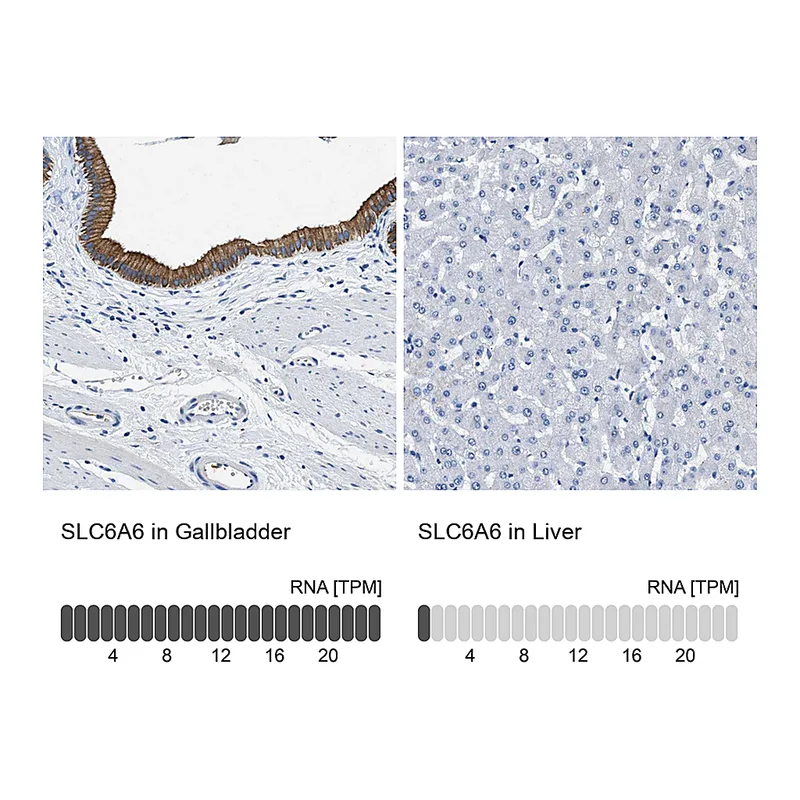 Atlas Antibodies Anti-SLC6A6 Antibody