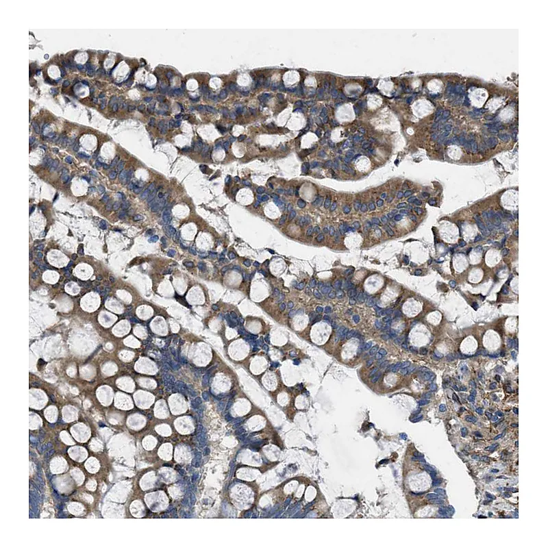 Atlas Antibodies Anti-SLC6A9 Antibody