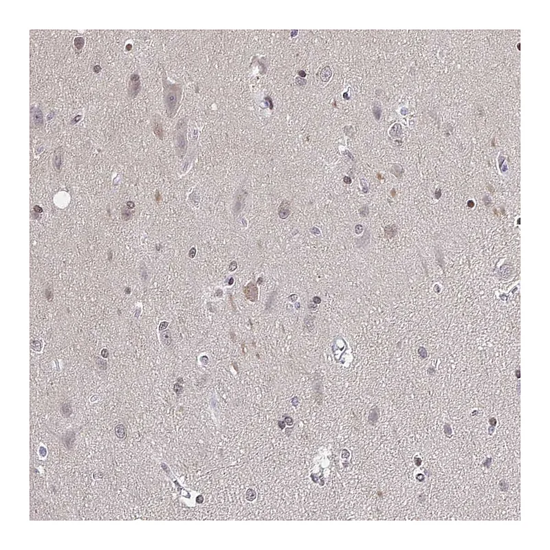 Atlas Antibodies Anti-SLC7A10 Antibody