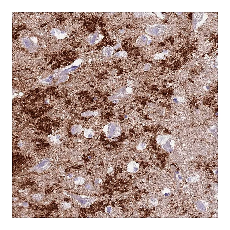 Atlas Antibodies Anti-SLC7A14 Antibody