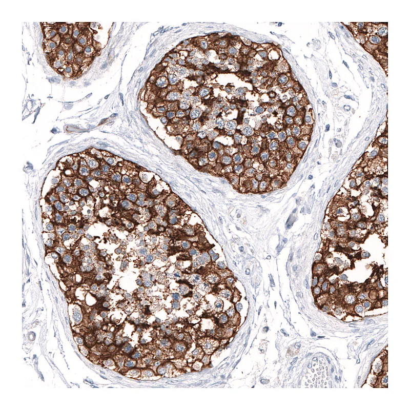 Atlas Antibodies Anti-SLC7A5 Antibody