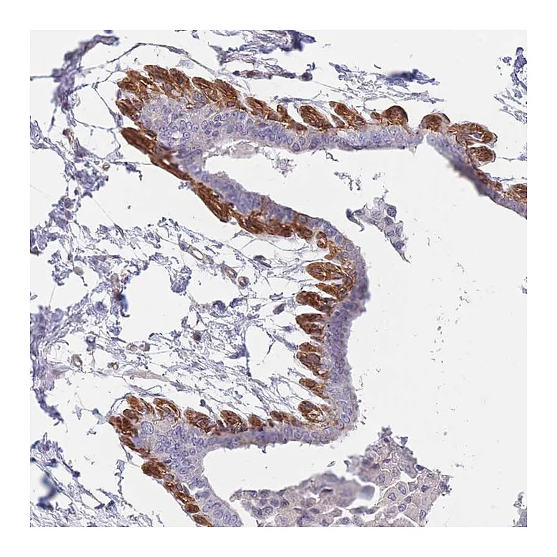 Atlas Antibodies Anti-SLC7A6 Antibody
