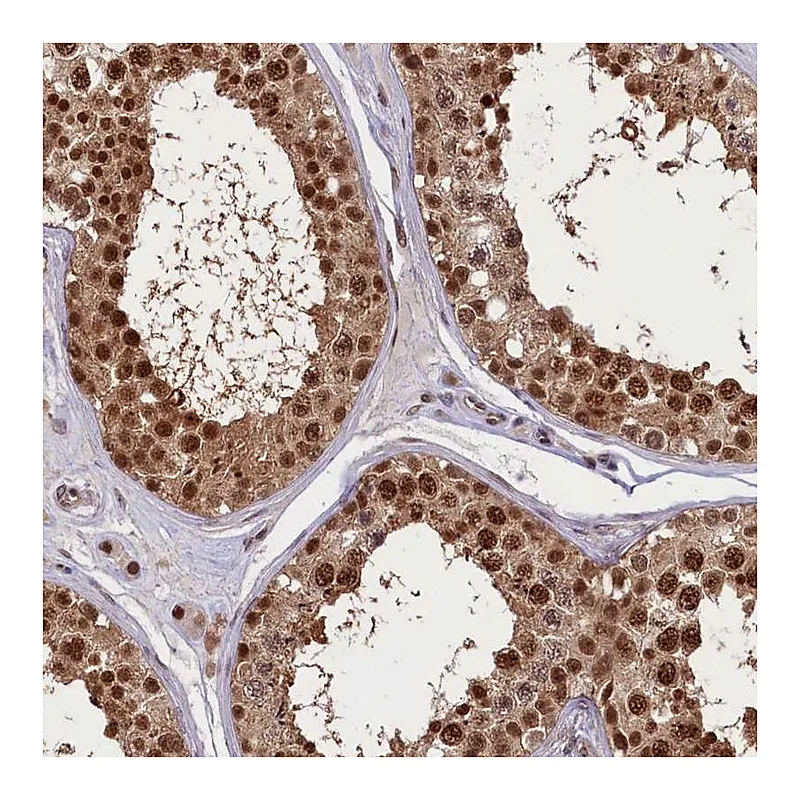 Atlas Antibodies Anti-SLC7A6OS Antibody
