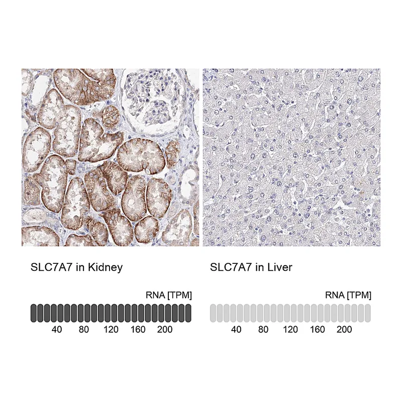 Atlas Antibodies Anti-SLC7A7 Antibody