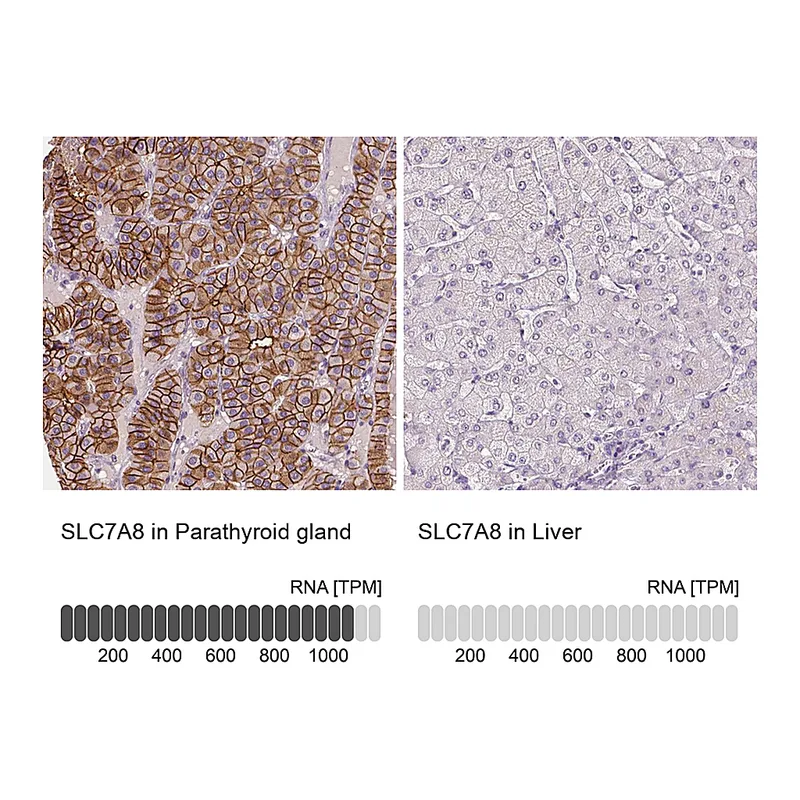 Atlas Antibodies Anti-SLC7A8 Antibody