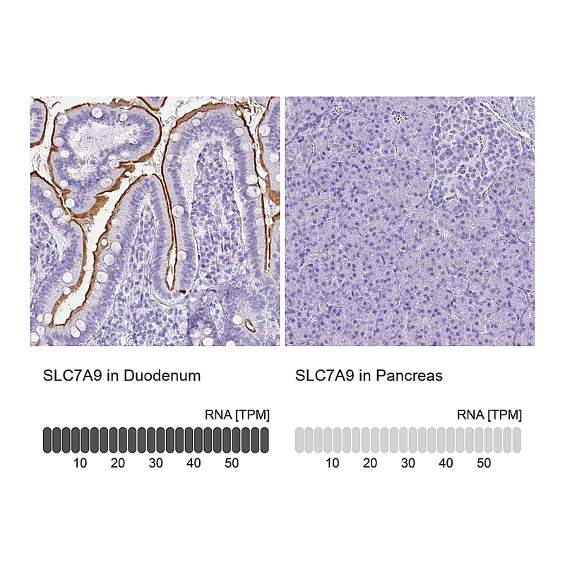 Atlas Antibodies Anti-SLC7A9 Antibody