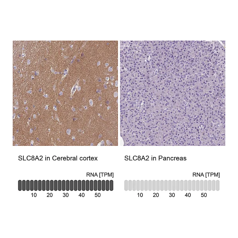 Atlas Antibodies Anti-SLC8A2 Antibody