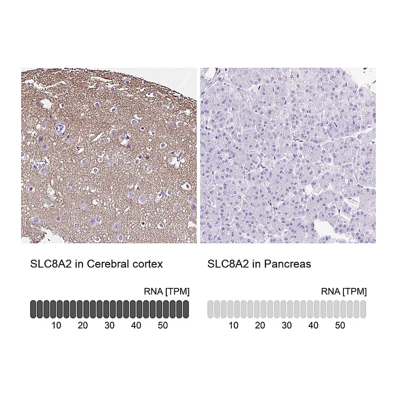 Atlas Antibodies Anti-SLC8A2 Antibody