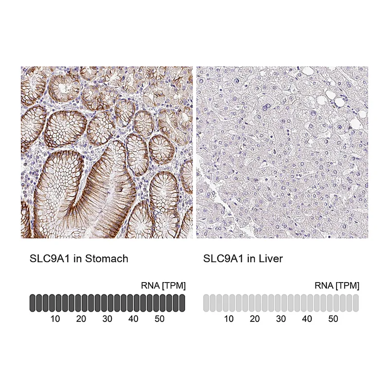 Atlas Antibodies Anti-SLC9A1 Antibody