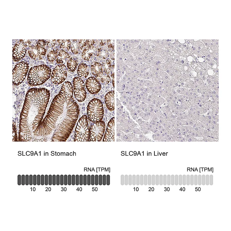 Atlas Antibodies Anti-SLC9A1 Antibody