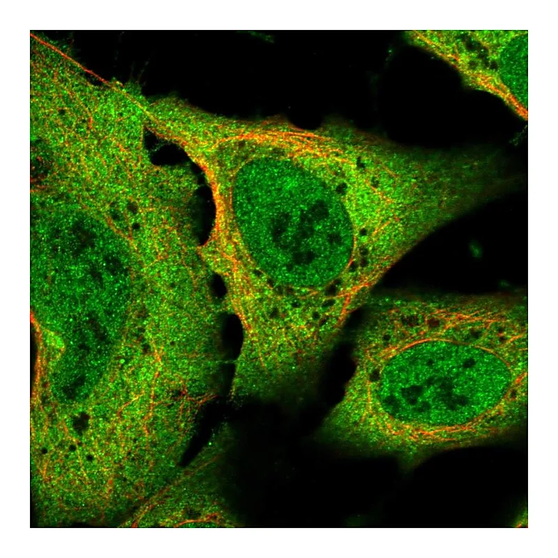 Atlas Antibodies Anti-SLC8A1 Antibody