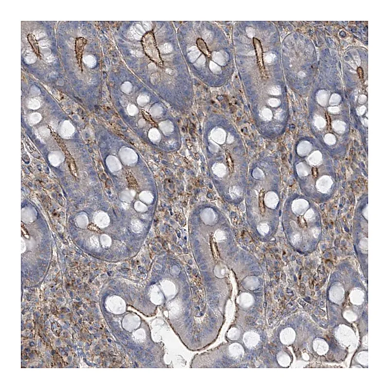 Atlas Antibodies Anti-SLC9A2 Antibody