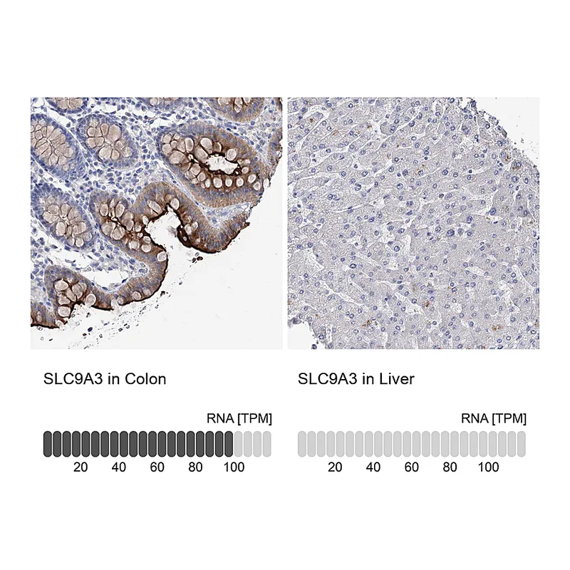 Atlas Antibodies Anti-SLC9A3 Antibody