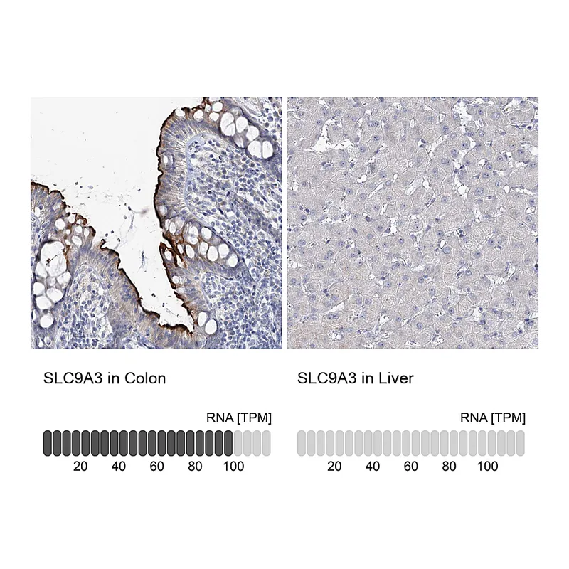 Atlas Antibodies Anti-SLC9A3 Antibody