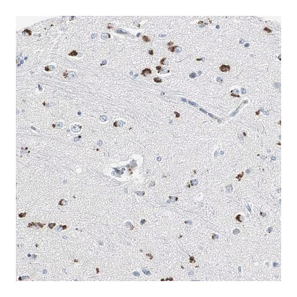 Merck Anti-SERPINF1 antibody produced in rabbit