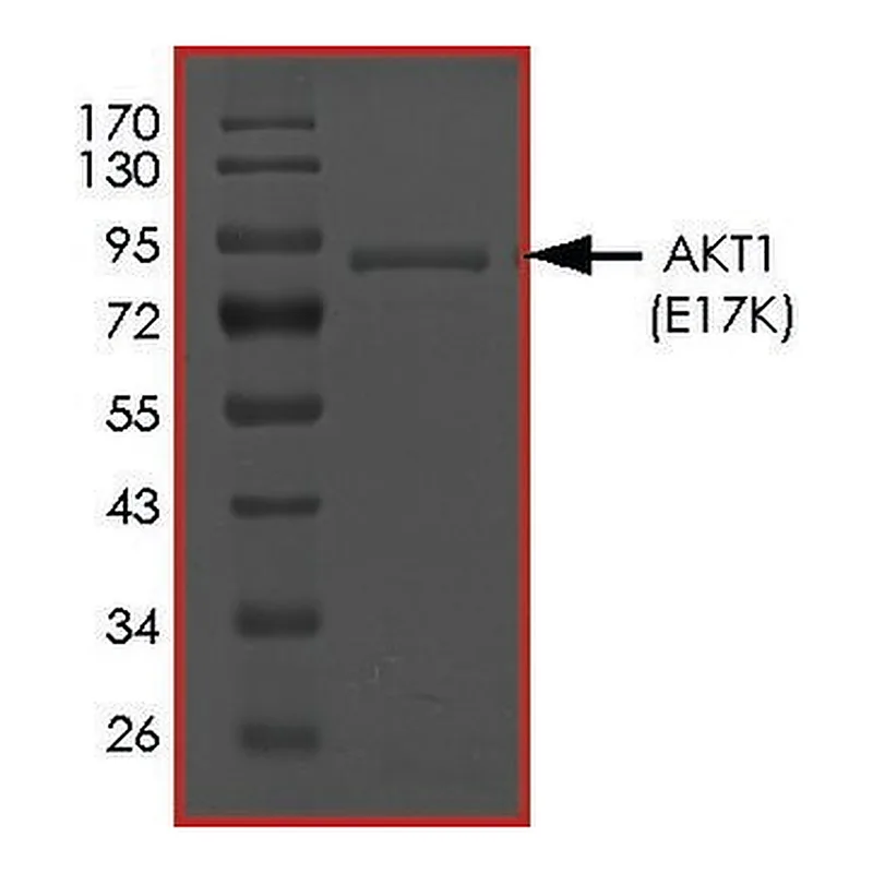 Merck AKT1 (E17K), ACTIVE