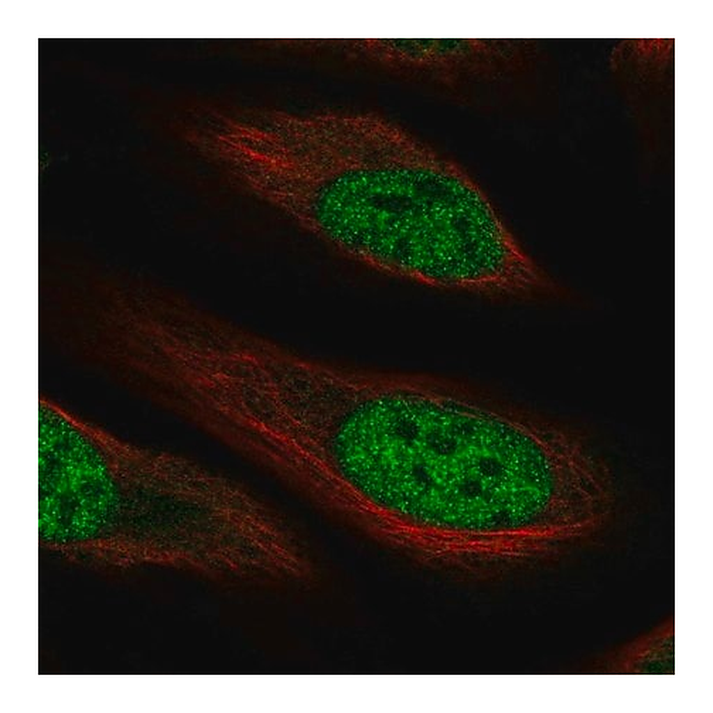 Merck Anti-RHBDL1 antibody produced in rabbit