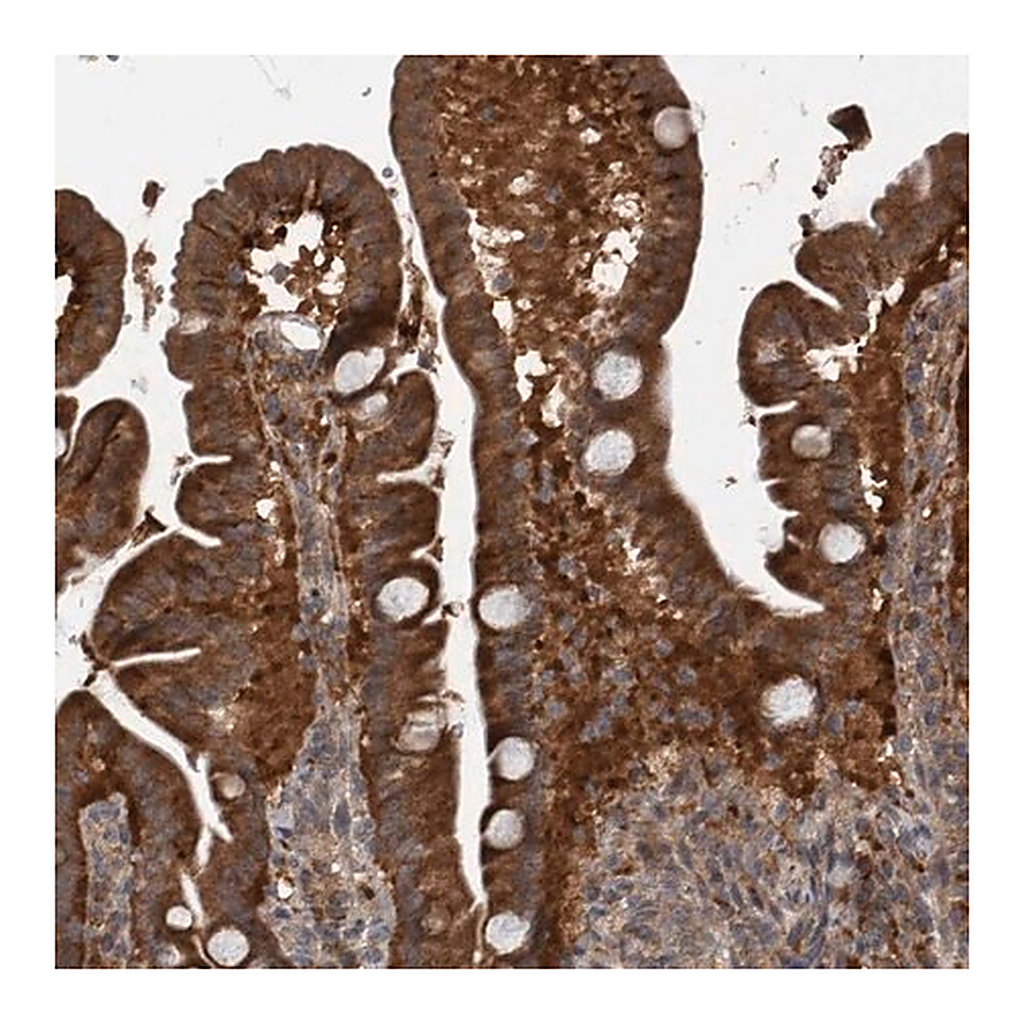 Merck Anti-RABGGTB antibody produced in rabbit