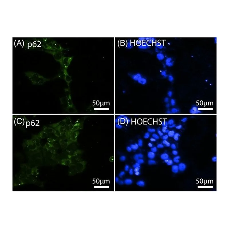 Thermo Fisher Scientific Goat anti-Rabbit IgG (H+L) Highly Cross-Adsorbed Secondary Antibody, Alexa Fluor 594