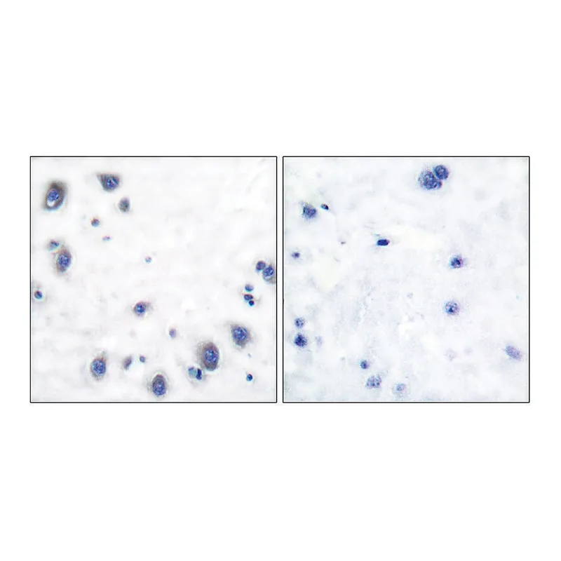 Merck Anti-Tyrosine Hydroxylase, N-Terminal antibody produced in rabbit