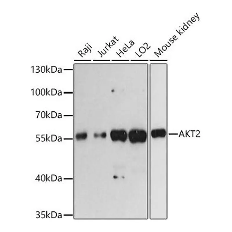 Merck Anti- AKT2 antibody produced in rabbit