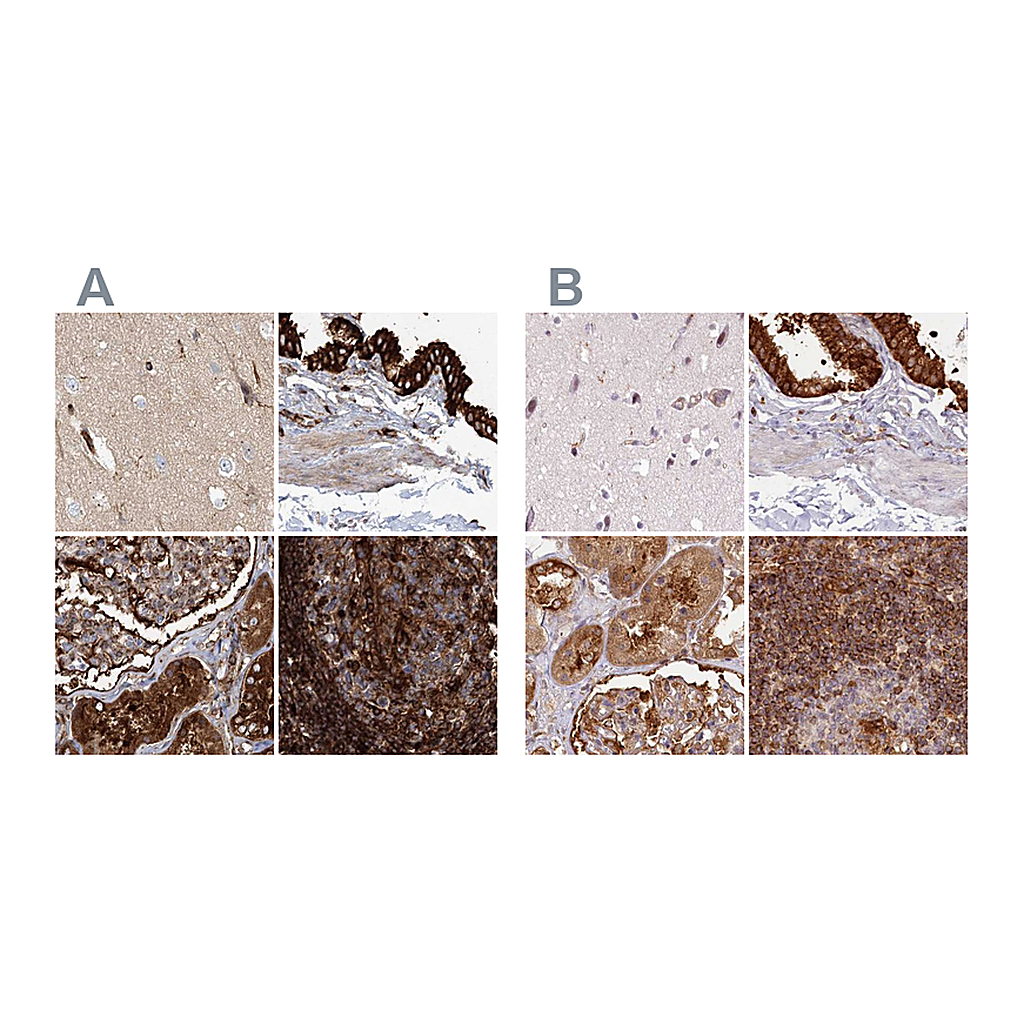 Atlas Antibodies Anti-EML4 Antibody