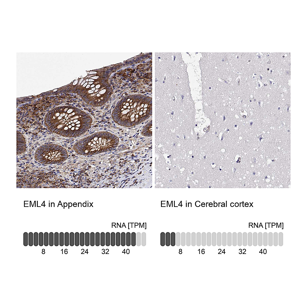 Atlas Antibodies Anti-EML4 Antibody