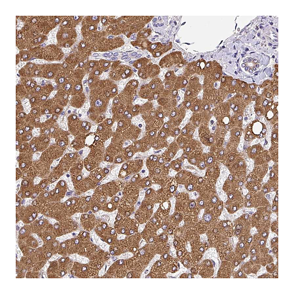 Atlas Antibodies Anti-EML5 Antibody