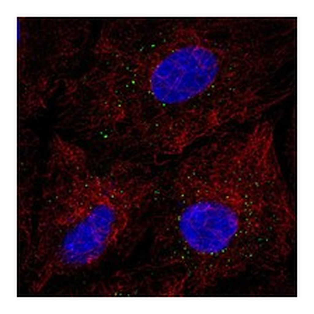 Atlas Antibodies Anti-EMP3 Antibody