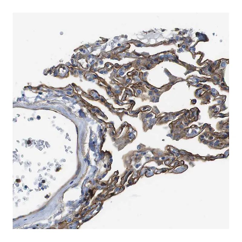 Atlas Antibodies Anti-EMP2 Antibody