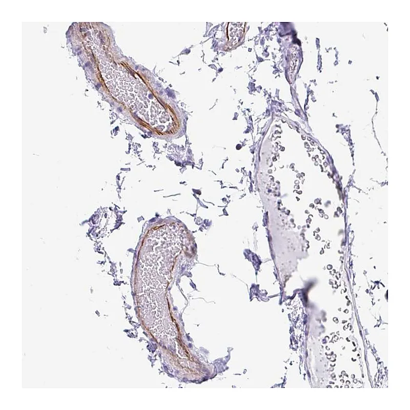 Atlas Antibodies Anti-EML5 Antibody