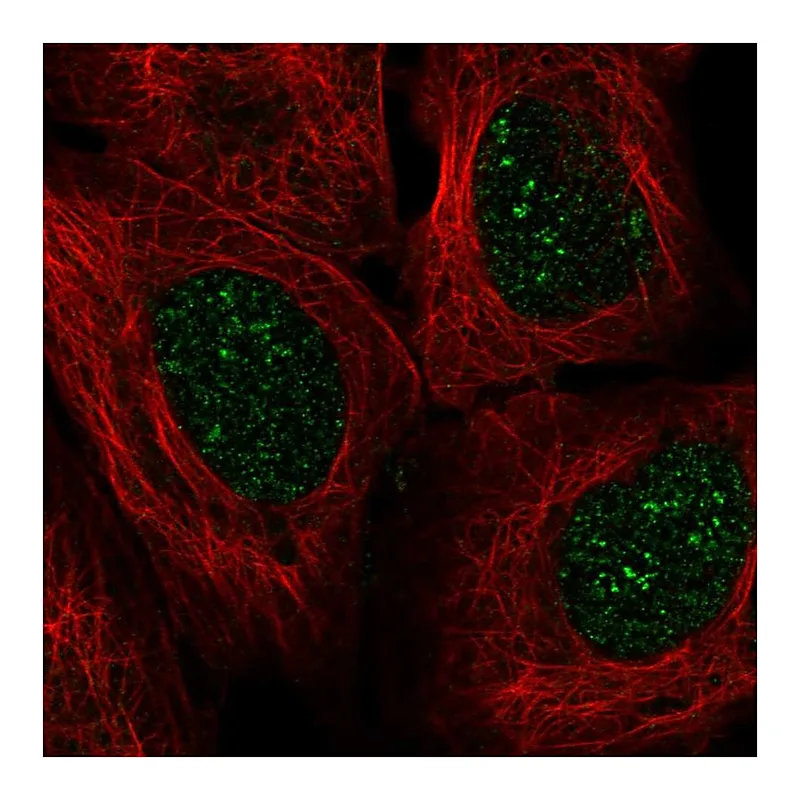 Atlas Antibodies Anti-EN2 Antibody