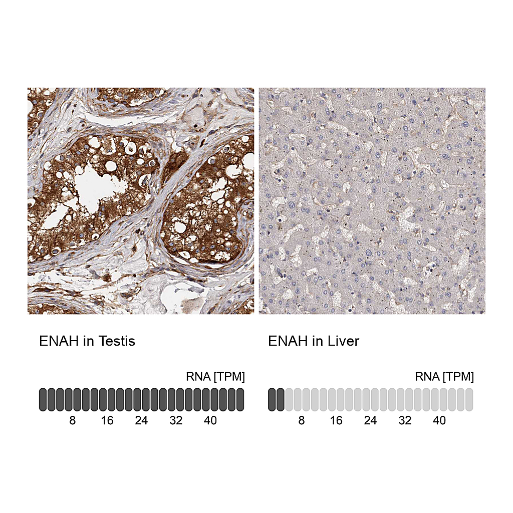 Atlas Antibodies Anti-ENAH Antibody