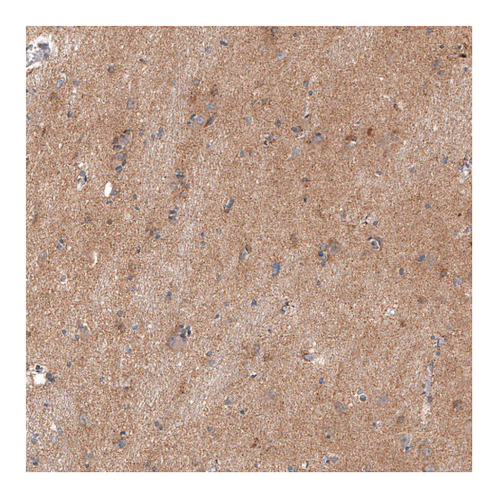 Atlas Antibodies Anti-ENHO Antibody