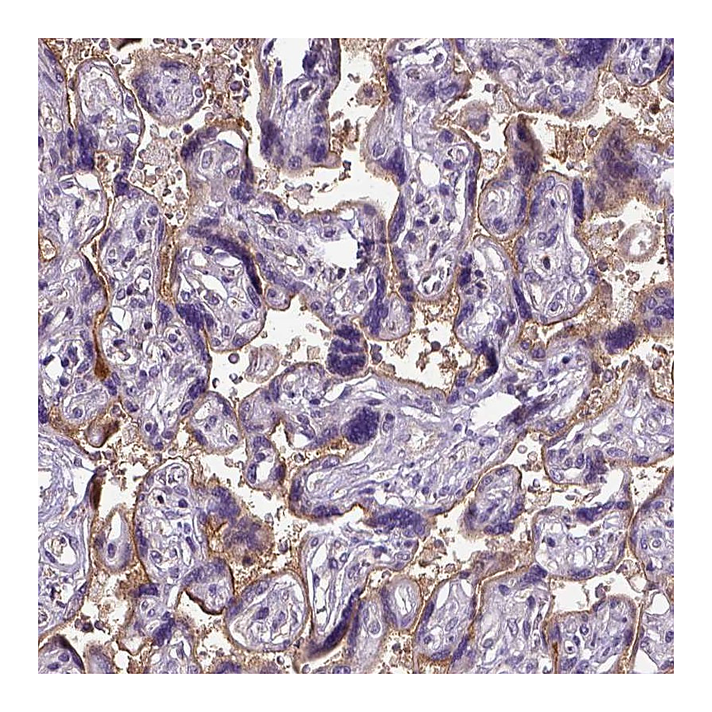 Atlas Antibodies Anti-ENG Antibody